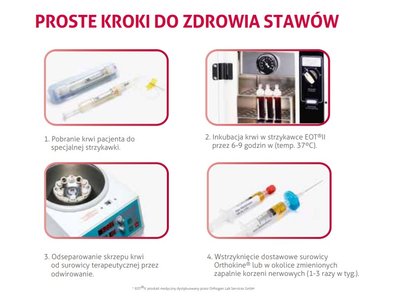 Terapia Orthokine - leczenie zwyrodnienia stawów | Klinika Bałtycka Gdańsk