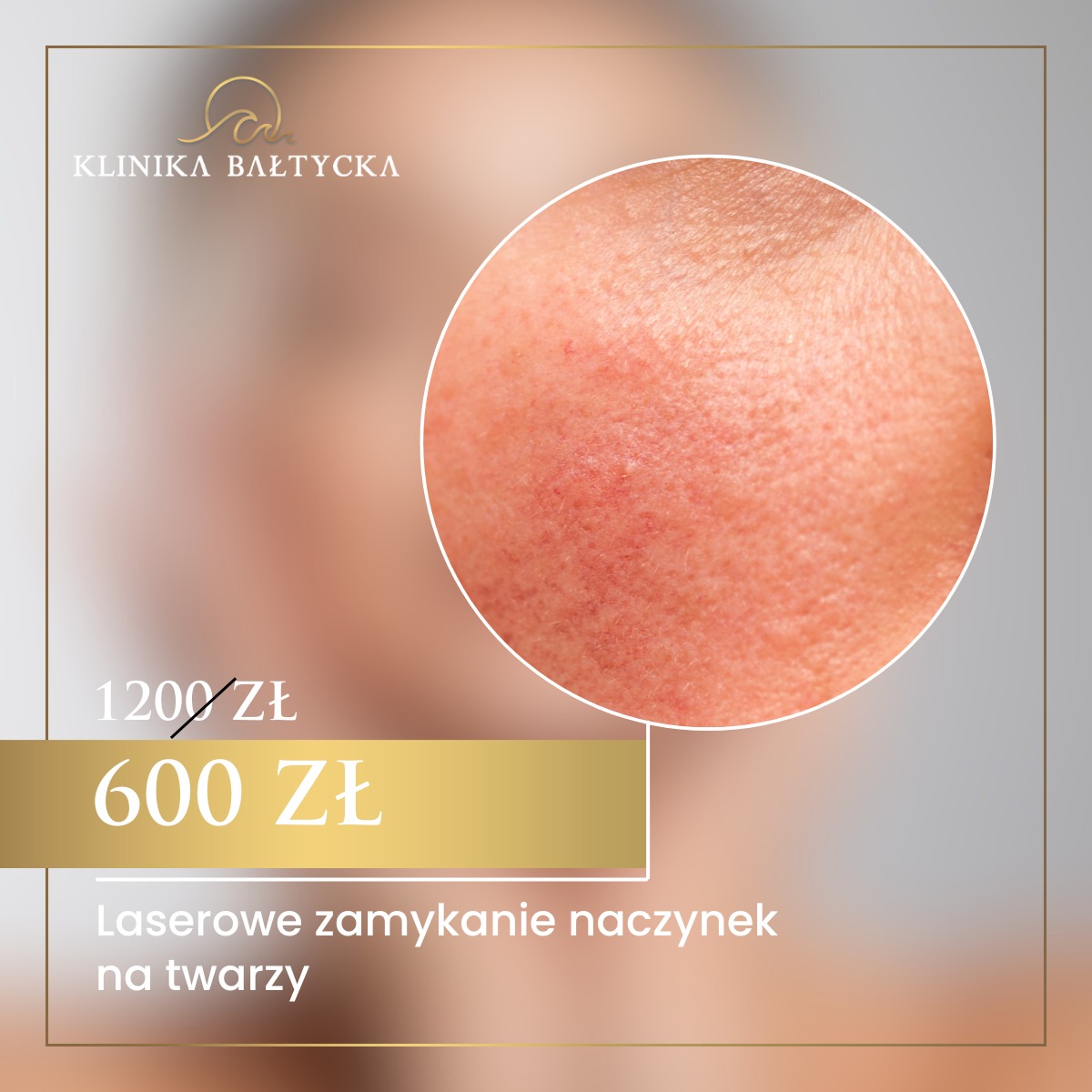 Zdjęcie WhatsApp 2024-04-12 o 17.59.37_44e10bd4